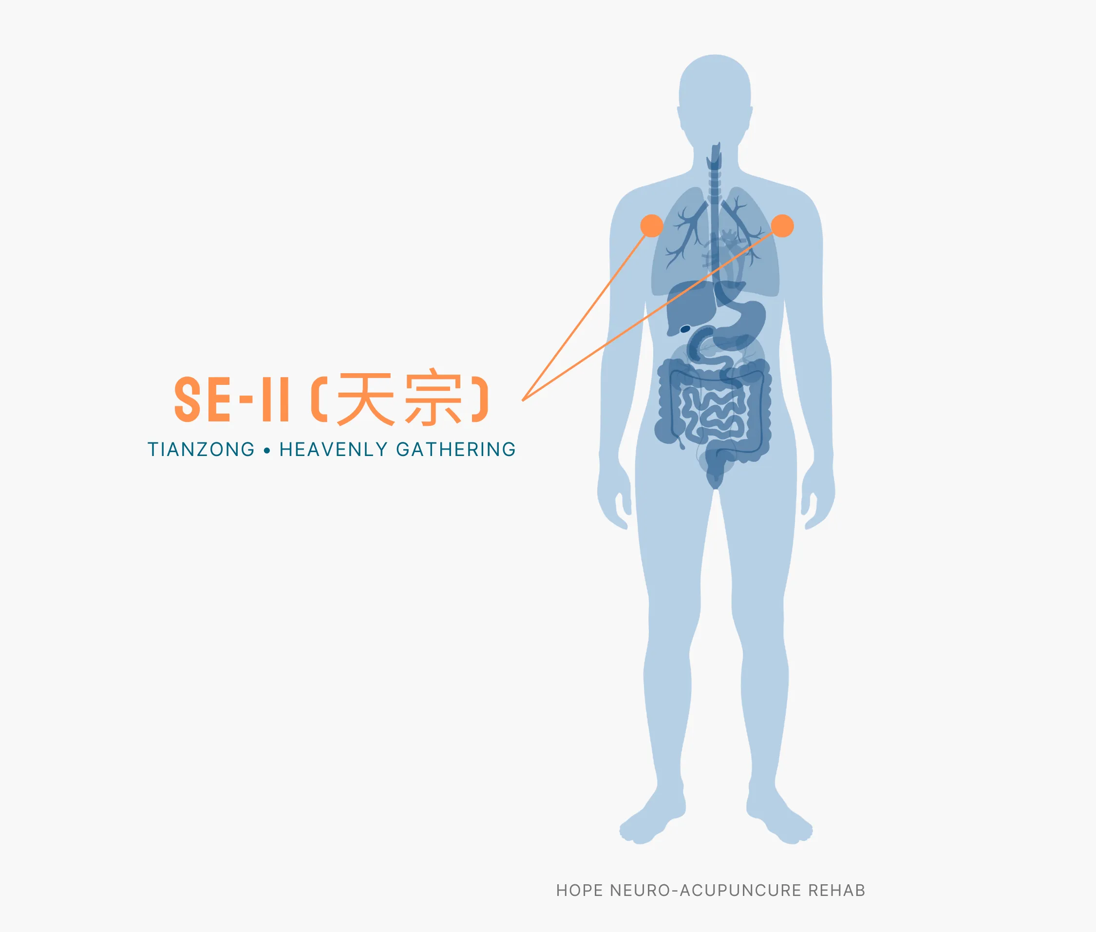Diagram Showing Where the SI-11 Acupuncture Point (also known as Tianzhong or Heavenly Gathering) is within the Small Intestine Meridians