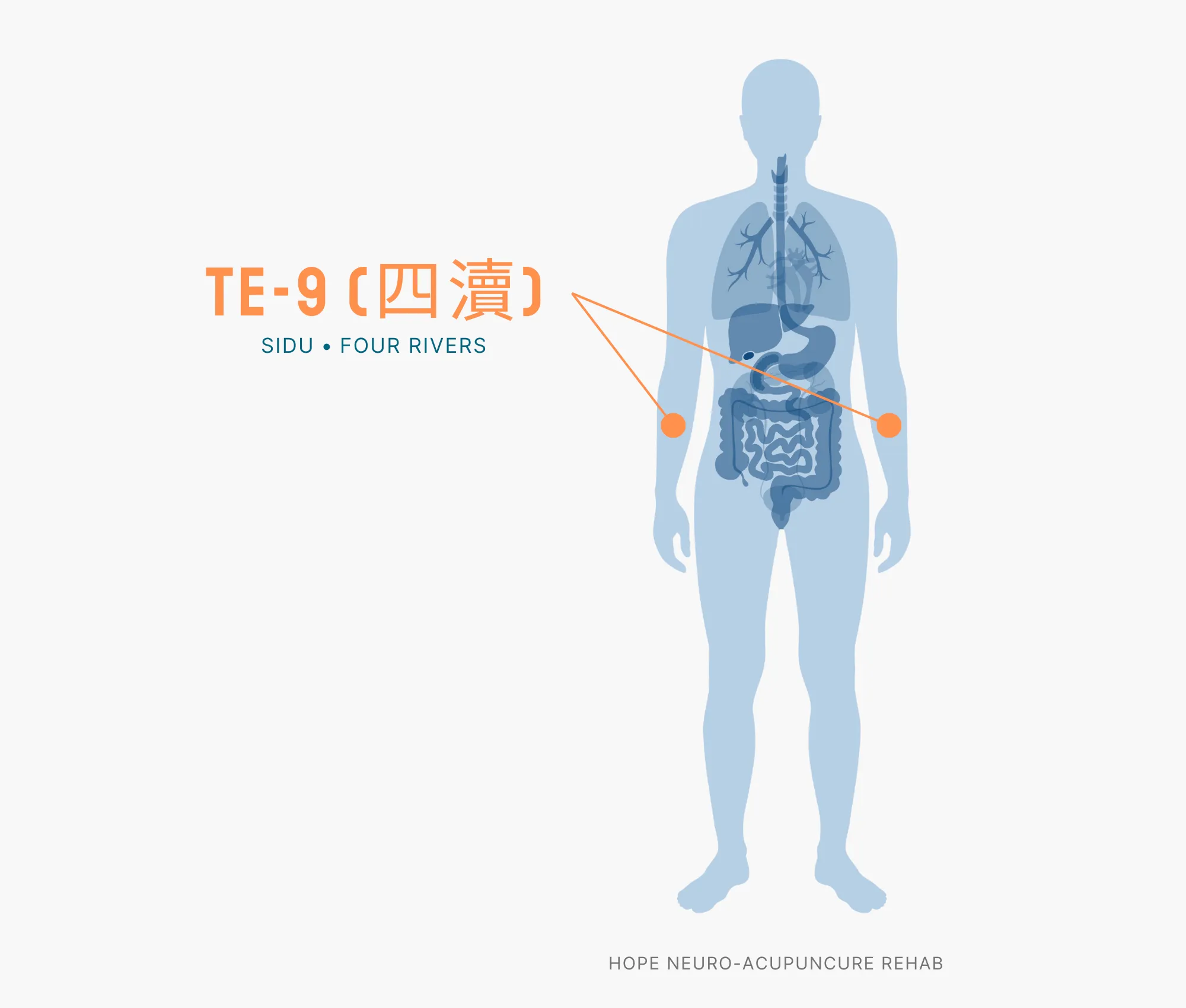 Diagram Showing Where the TE-9 Acupuncture Point (also known as Sidu or Four Rivers) is within the Triple Burner Meridian