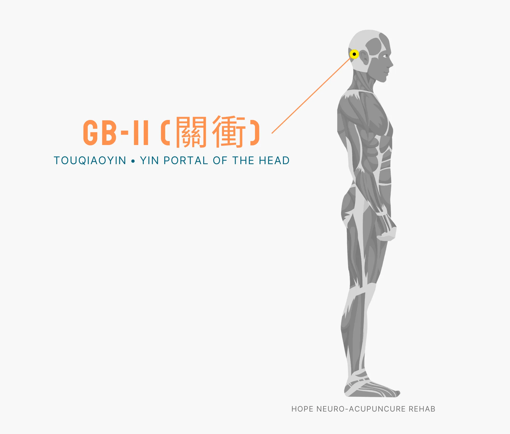 Diagram Showing Where the GB-1 Acupuncture Point (also known as (Tongziliao or Pupil Crevice) is within the Gallbladder Meridian